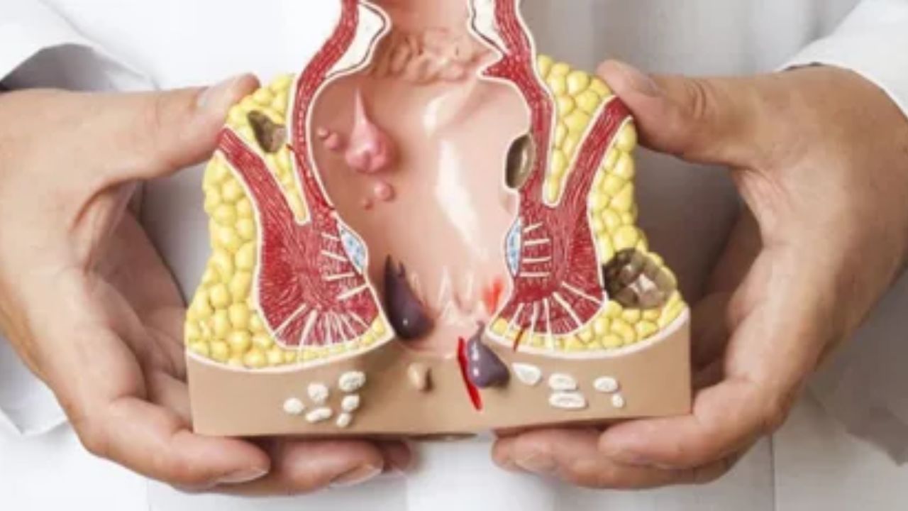 Periodontics Treatment