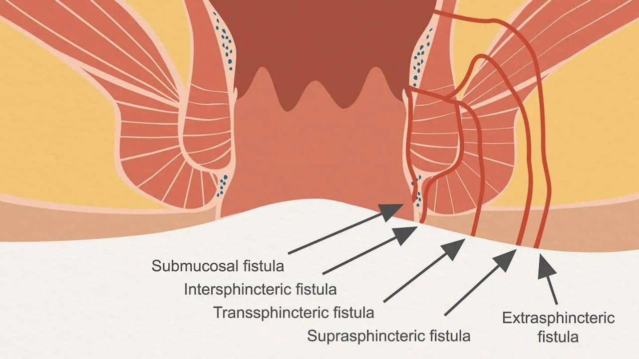 Prosthodontics Treatment